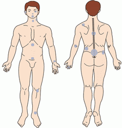 kinesiology tape vendaje neuromuscular cross tape