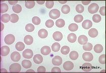 sangre hematies globulos rojos hemoglobina blancos