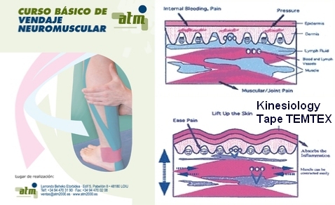 Curso de Vendaje Neuromuscular en Zarauz (Guipuzcoa)