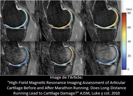 La Course de Distance Longue favorise la dtrioration du cartilage? Control avec rsonance Magntique du Cartilage Articulaire du genou, Avant et Aprs d'une course Marathon