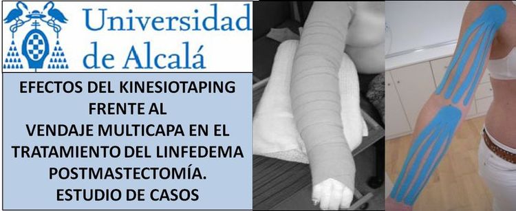 Effets du Kinesiotaping face au Bandage Multi cape dans le Traitement du Lymphedme Post-Mammectomie. Etude de Cas