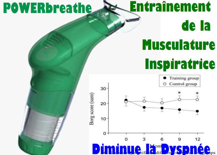 L'Entranement de la Musculature Inspiratrice chez des Patients atteints de MPOC (Maladie Pulmonaire Obstructive Chronique) amliore la Dyspne et la Qualit de Vie