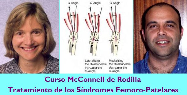Curso sobre el Método McConnell en el abordaje de los Síndromes Fémoro-Patelares