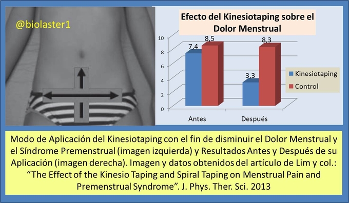 El uso del Kinesiotaping es efectivo en la prevencin del Dolor Menstrual