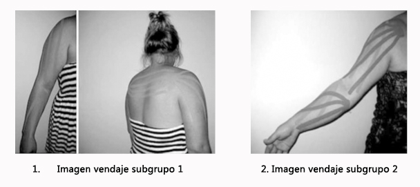 Kinesiotaping aplicado al linfedema de la extremidad superior en mujeres tras cirug�a por c�ncer de mama