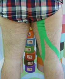 Kinesiotaping aplicado a los isquiotibiales