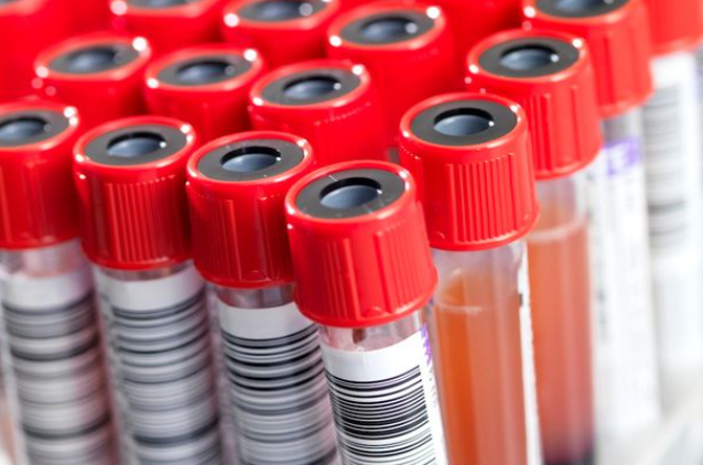 Cambios Fisiologicos y hematologicos en respuesta a diferentes dosis de EPO