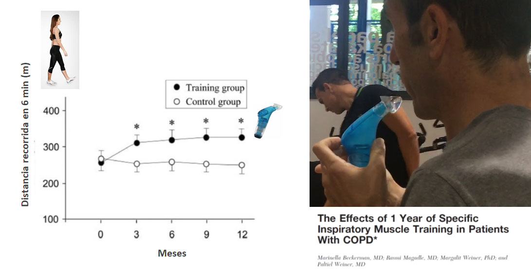 En EPOC el Entrenamiento Respiratorio Mejora la Capacidad de ejercicio en un 20%