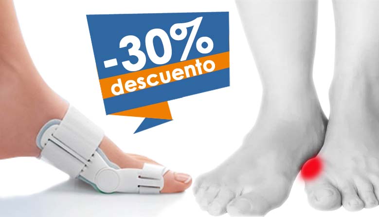 Conoces la rtesis Correctora de Juanete, Hallufix?
