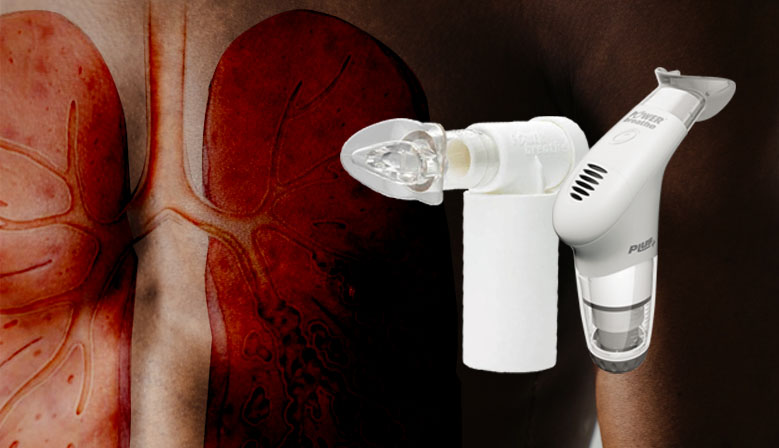 Eficacia del Entrenamiento de la Musculatura Respiratoria en personas con Bronquiectasia: Revisin Sistemtica