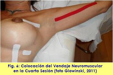 kinesiology taping vendaje neuromuscular linfatico adherencia cicatrizal AWS